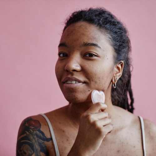 Acne-Prone Skin? Here’s Why Your Natural Remedies Aren’t Working